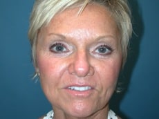After Image