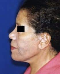 After Image