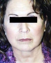 After Image