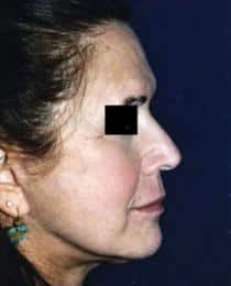 After Image