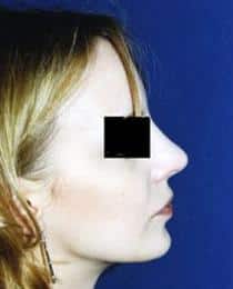 After Image