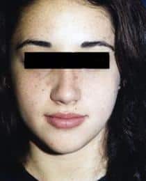 After Image