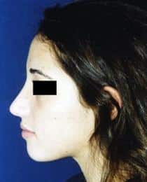 After Image