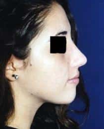 After Image