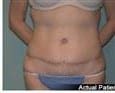 After Image