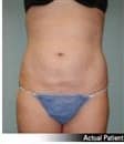 After Image