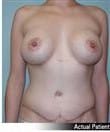 After Image