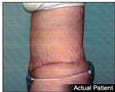After Image