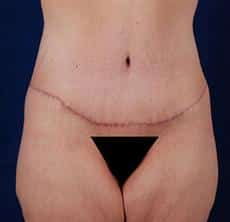 After Image