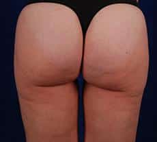 After Image