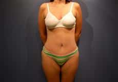 After Image