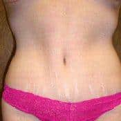After Image