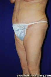 After Image