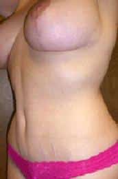 After Image