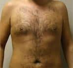 After Image