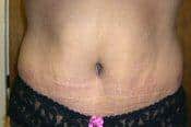 After Image