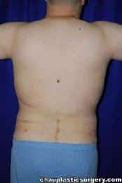 After Image