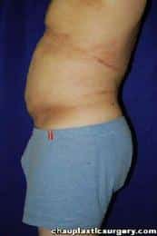 After Image