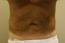 After Image