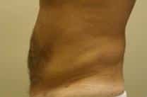 After Image