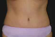 After Image
