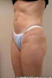 After Image