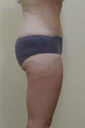 After Image