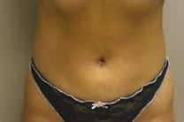 After Image