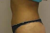 After Image