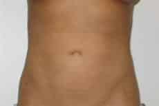 After Image