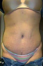 After Image
