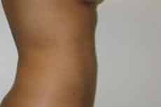 After Image