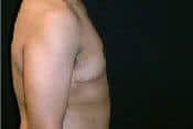 After Image
