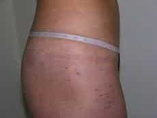 After Image