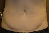 After Image