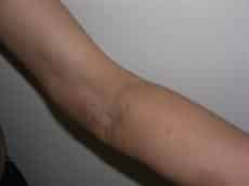 After Image