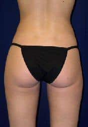 After Image