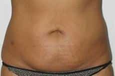 After Image