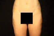 After Image