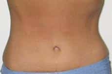 After Image