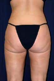 After Image