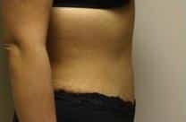 After Image