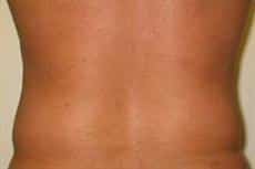 After Image