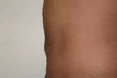 After Image