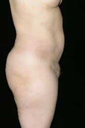 After Image