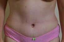 After Image
