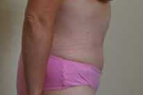 After Image