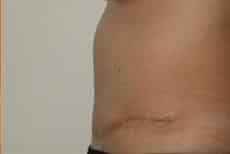After Image