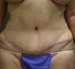 After Image