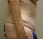 After Image